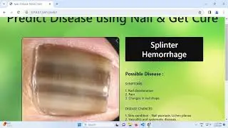 Disease prediction using Nail through machine learning.