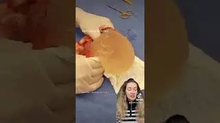 Порвался грудной имплант??? К чему это приводит