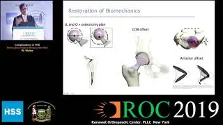 Complications in THA - Dislocation: How to Reduce the Risk - Dr. W. Walter