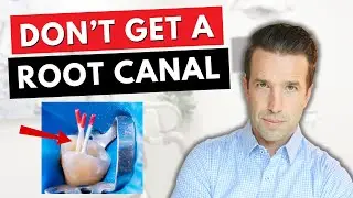 Dont get a ROOT CANAL before watching this!