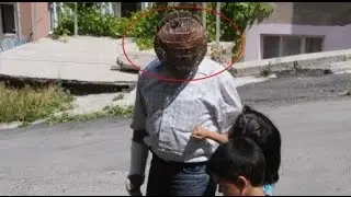 Man Wears Copper Wire Cage on His Head to Quit Smoking- İbrahim Yücel