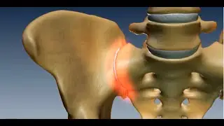 Where is the Sacroiliac Joint? Anatomy of the Sacroiliac Joint