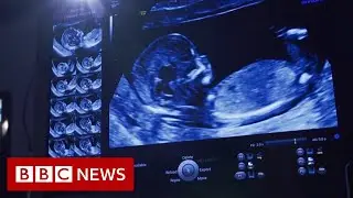 Private baby scan studios ‘a growing concern’ - BBC News