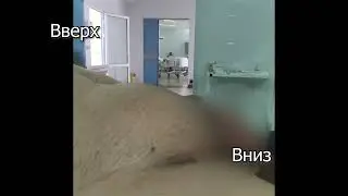 Невправимая пахово мошоночная грыжа справа  Вид больного сбоку  Проверка кашлевого симптома
