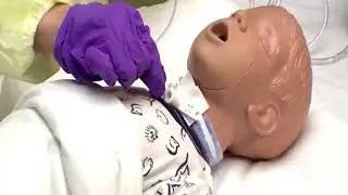 Tracheostomy Suctioning