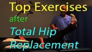 Top Exercises after Hip Replacement