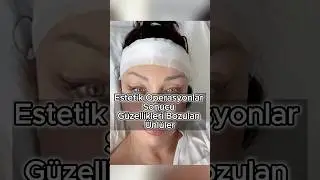 Estetik Operasyonlar Sonucu Güzellikleri Bozulan Ünlüler 📽️