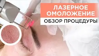 ЛАЗЕРНОЕ ОМОЛОЖЕНИЕ: Просто о сложном и преимущества процедуры