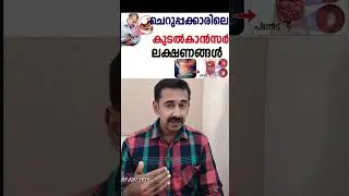 ചെറുപ്പക്കാരിലെ  കുടൽകാൻസർ ലക്ഷണങ്ങൾ Colon cancer Reason