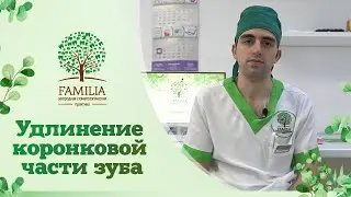 ➡ Удлинение коронковой части зуба