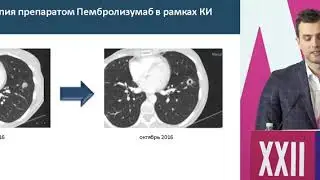 Лечение BRCA мутированного РМЖ: всегда ли оправданы стандарты?