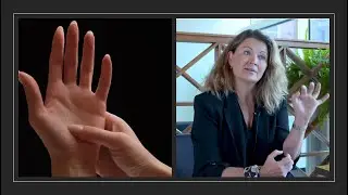 متلازمة النفق الرسغي" الألم والخدر على اليدين والذراعين -الدكتورة إليزابيت هاغرت استشاري جراحة اليد"