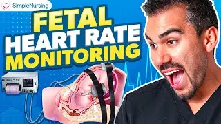 Fetal Heart Rate Monitor for Nursing | Decelerations, Key Terms NCLEX