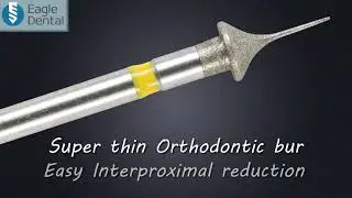 Easy IPR burs: 0.3 mm Interproximal bur for stripping & Invisalign