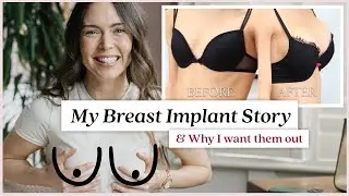 My Breast Implant Story