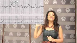 CTG cardiotocography what is CTG why is it done , how does it affect the baby