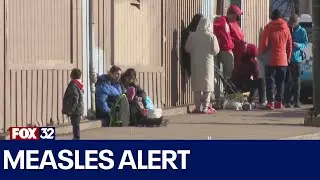 Measles in Chicago: 5 confirmed cases, most among migrants