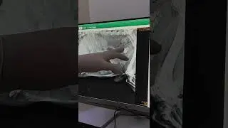 Рентген Арчика