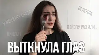 10 ФАКТОВ О МОЕМ ТЕЛЕ/ВОТКНУЛА ВИЛКУ В ГЛАЗ