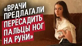 Я родилась с 1 пальцем и аномалиями конечностей: Таня | Быть молодым