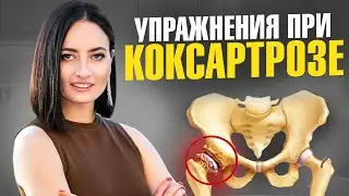 ПОСЛЕ 40 лет у 80% людей уже есть коксартроз | Простой ТЕСТ и упражнения при коксартрозе