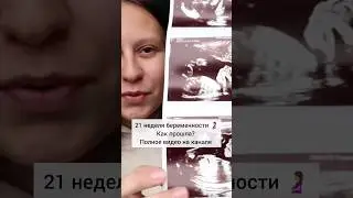 Полное видео про 21 неделю мой второй беременности уже на канале 🙌 #беременность