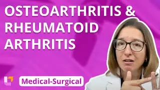 Osteoarthritis and Rheumatoid Arthritis - Medical-Surgical - Musculoskeletal System | @LevelUpRN