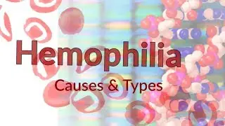 Hemophilia | Types & Casues | Blood Clotting Factors & Mechanism | Hemophilia & Joints