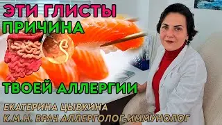 ГЛИСТЫ И АЛЛЕРГИЯ. Какие паразиты вызывают аллергию. Врач аллерголог иммунолог Екатерина Цывкина