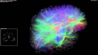 Artificial Brain Simulation - Thalamocortical System, 8 Million Neurons - 1.4 Billion Synapses