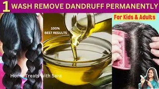 HOW TO TREAT DANDRUFF AT HOME in 1st Wash, Remove Dandruff Permanently| 100% Natural Powerful Remedy