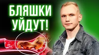 СОСУДЫ РАЗРУШАЮТСЯ — ЧТО ДЕЛАТЬ? / Чистим сосуды и сердце!