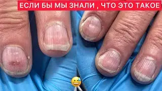 НАРАЩИВАНИЕ ЗА ЧАС❓НОВОГОДНИЕ НОГТИ 2023