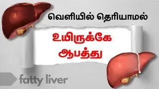 Fatty Liver - How to Treat Detoxify & Reverse | 24 Tamil Health