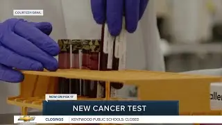 Holy 'GRAIL' of cancer screening? Digging into the Galleri test with Dr. Bitner