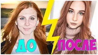 МОЯ КОЖА В ПОДРОСТКОВОМ ВОЗРАСТЕ VS СЕЙЧАС