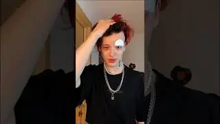 Что под повязкой показал в ТГК: pasha_pai 🤯 