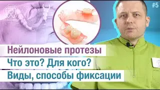 Нейлоновые зубные протезы. Кому подходят? Виды протезов. Способы фиксации