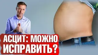 Асцит печени👉Причины асцита и симптомы асцита. Как лечить асцит