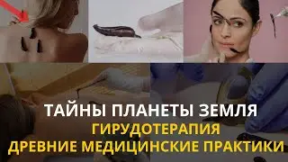 Тайны планеты  Земля. Гирудотерапия. Древние медицинские практики. Интересные факты 