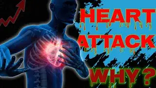 Why Heart Attacks Are Increasing In India - Avoid Heart Attack [Tamil]