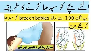 Breech position baby turn cephalic | Ulta bacha sidha @Drmrssaeed