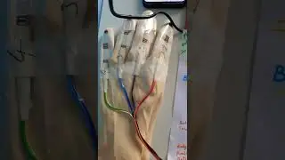 IOT BASED AUTOMATED PARALYSIS PATIENT HEALTHCARE SYSTEM USING ARDUINO WITH GPRS