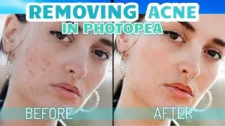 How to EASILY remove blemishes in Photopea! (Photopea/Photoshop tutorial)