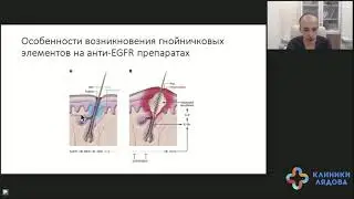 Побочные явления после таргетной терапии. Разговор с онкологом