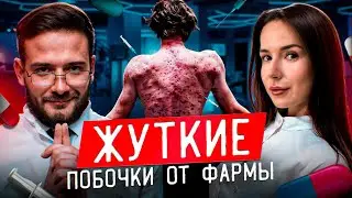 ПОБОЧКИ ОТ СТЕРОИДОВ | ПОБОЧНЫЕ ЭФФЕКТЫ ОТ ФАРМЫ