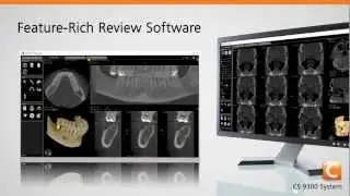 CARESTREAM CS 9300 for Point-of-Care ENT and Dental Imaging