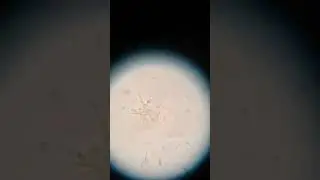 Препарат Байкал ЭМ-1 под микроскопом.