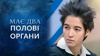 ШОК! Гермафродит с ДВУМЯ ПОЛОВЫМИ ОРГАНАМИ! 