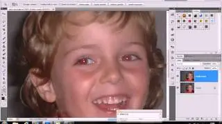 ojos rojos